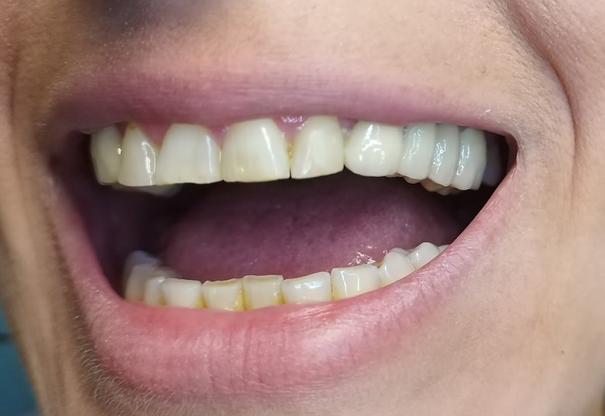 Opšta stomatologija - S DENTAL