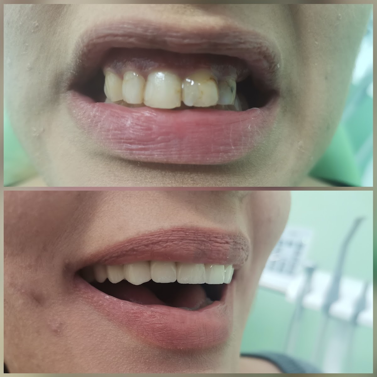 Rezultati koji se vide - S DENTAL